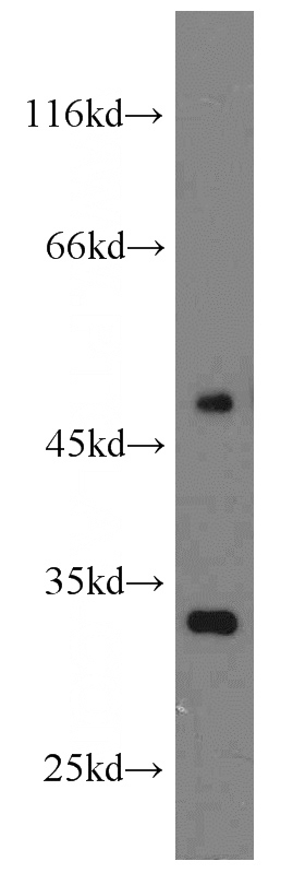 HeLa cells were subjected to SDS PAGE followed by western blot with Catalog No:109389(CLIC3 antibody) at dilution of 1:800