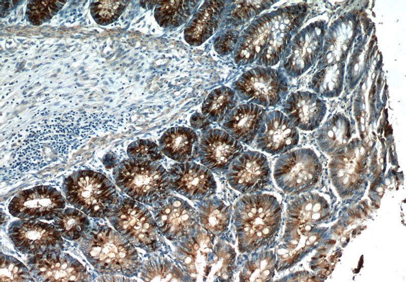 Immunohistochemistry of paraffin-embedded human colon slide using Catalog No:116355(TFF3 Antibody) at dilution of 1:50