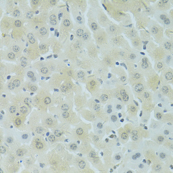 Immunohistochemistry - RSRC1 Polyclonal Antibody 
