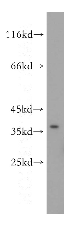 HepG2 cells were subjected to SDS PAGE followed by western blot with Catalog No:111925(KCNAB2 antibody) at dilution of 1:500