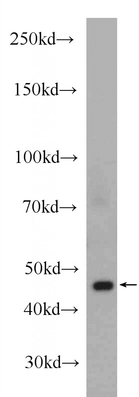 mouse heart tissue were subjected to SDS PAGE followed by western blot with Catalog No:107864(ACTC1 Antibody) at dilution of 1:1000