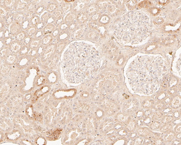 Fig5:; Immunohistochemical analysis of paraffin-embedded human kidney tissue using anti-TREM2 antibody. The section was pre-treated using heat mediated antigen retrieval with Tris-EDTA buffer (pH 8.0-8.4) for 20 minutes.The tissues were blocked in 5% BSA for 30 minutes at room temperature, washed with ddH; 2; O and PBS, and then probed with the primary antibody ( 1/200) for 30 minutes at room temperature. The detection was performed using an HRP conjugated compact polymer system. DAB was used as the chromogen. Tissues were counterstained with hematoxylin and mounted with DPX.