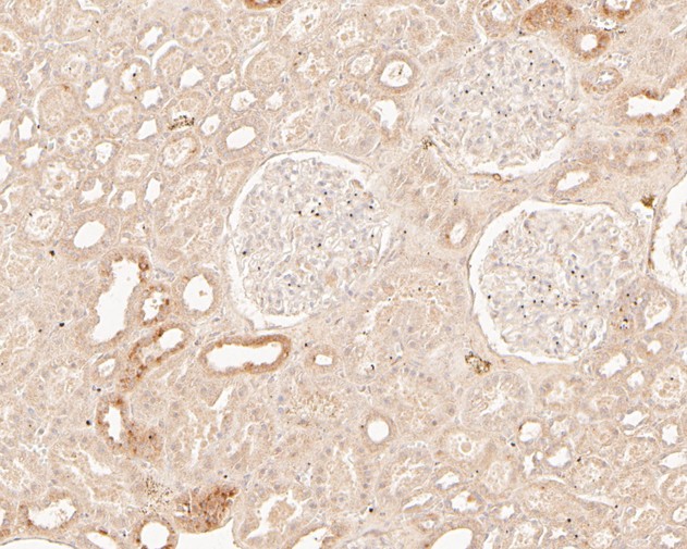 Fig5:; Immunohistochemical analysis of paraffin-embedded human kidney tissue using anti-TREM2 antibody. The section was pre-treated using heat mediated antigen retrieval with Tris-EDTA buffer (pH 8.0-8.4) for 20 minutes.The tissues were blocked in 5% BSA for 30 minutes at room temperature, washed with ddH; 2; O and PBS, and then probed with the primary antibody ( 1/200) for 30 minutes at room temperature. The detection was performed using an HRP conjugated compact polymer system. DAB was used as the chromogen. Tissues were counterstained with hematoxylin and mounted with DPX.