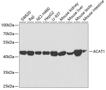 Western blot - ACAT1 Polyclonal Antibody 