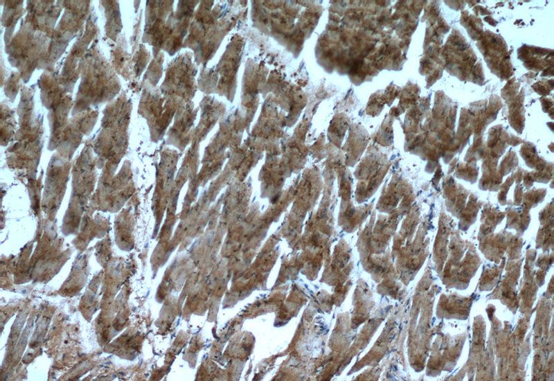 Immunohistochemistry of paraffin-embedded human heart tissue slide using Catalog No:112943(MYL3 Antibody) at dilution of 1:50 (under 10x lens)