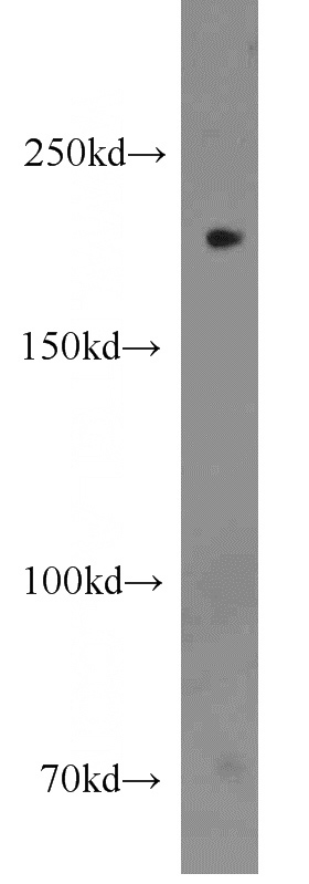 HEK-293 cells were subjected to SDS PAGE followed by western blot with Catalog No:109626(CUL7 antibody) at dilution of 1:300
