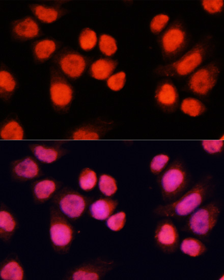 Immunofluorescence - CHAMP1 Polyclonal Antibody 