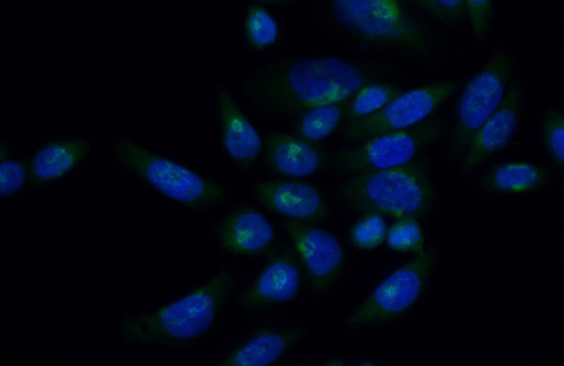 Immunofluorescent analysis of (10% Formaldehyde) fixed HeLa cells using Catalog No:107729(ACBD3 Antibody) at dilution of 1:50 and Alexa Fluor 488-congugated AffiniPure Goat Anti-Rabbit IgG(H+L)
