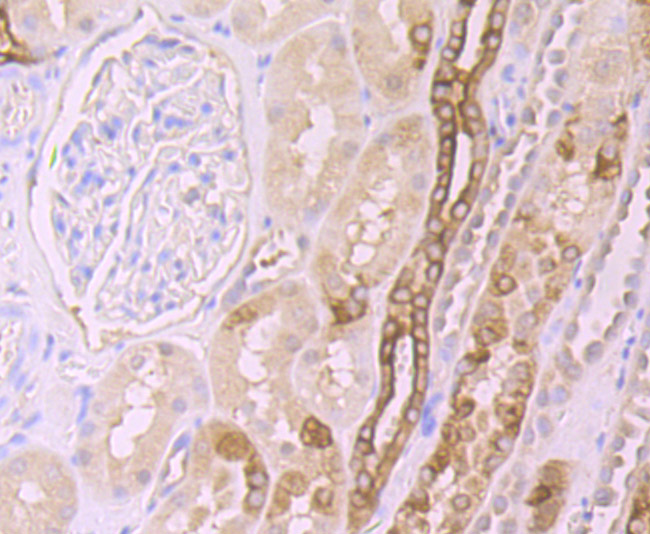 Fig3:; Immunohistochemical analysis of paraffin-embedded human kidney tissue using anti-Frizzled 8 antibody. The section was pre-treated using heat mediated antigen retrieval with Tris-EDTA buffer (pH 8.0-8.4) for 20 minutes.The tissues were blocked in 5% BSA for 30 minutes at room temperature, washed with ddH; 2; O and PBS, and then probed with the primary antibody ( 1/50) for 30 minutes at room temperature. The detection was performed using an HRP conjugated compact polymer system. DAB was used as the chromogen. Tissues were counterstained with hematoxylin and mounted with DPX.