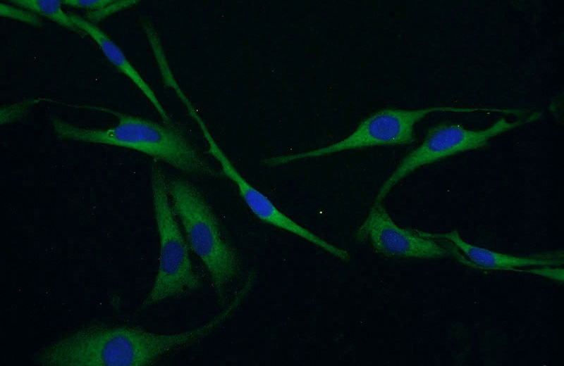 Immunofluorescent analysis of SKOV-3 cells using Catalog No:112704(MMP26 Antibody) at dilution of 1:50 and Alexa Fluor 488-congugated AffiniPure Goat Anti-Rabbit IgG(H+L)