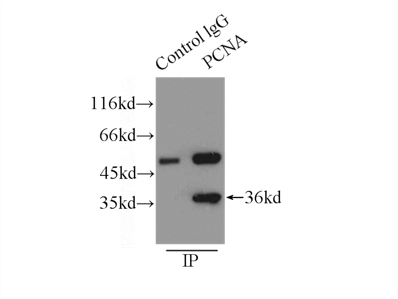 IP Result of anti-PCNA (IP:Catalog No:117336, 3ug; Detection:Catalog No:117336 1:1500) with MCF-7 cells lysate 2500ug.