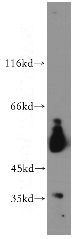 HL-60 cells were subjected to SDS PAGE followed by western blot with Catalog No:116799(VRK3 antibody) at dilution of 1:300