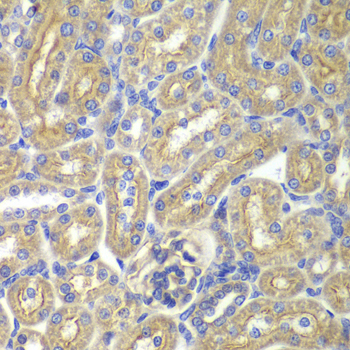 Immunohistochemistry - BAIAP2 Polyclonal Antibody 