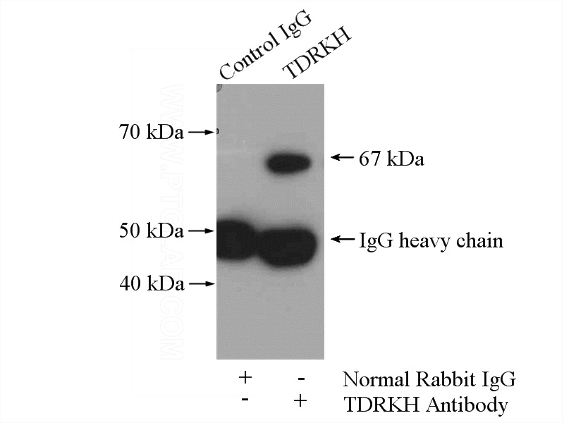 IP Result of anti-TDRKH (IP:Catalog No:115930, 4ug; Detection:Catalog No:115930 1:7000) with mouse brain tissue lysate 4000ug.