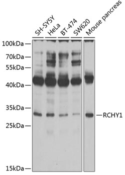 Western blot - RCHY1 Polyclonal Antibody 