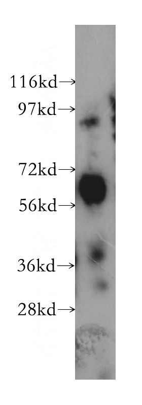 human cerebellum tissue were subjected to SDS PAGE followed by western blot with Catalog No:108176(ARSG antibody) at dilution of 1:300