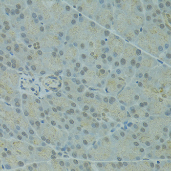 Immunohistochemistry - IVNS1ABP Polyclonal Antibody 