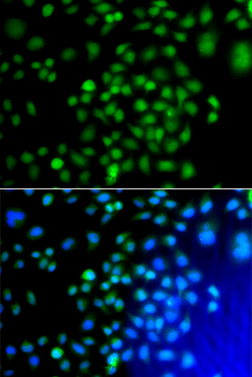 Immunofluorescence - ATF7 Polyclonal Antibody 