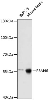 Western blot - RBM46 Polyclonal Antibody 