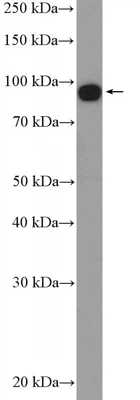 SKOV-3 cells were subjected to SDS PAGE followed by western blot with Catalog No:110186(EIF2C3-Specific Antibody) at dilution of 1:300