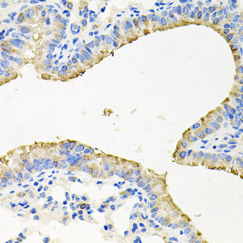 Immunohistochemistry - STRN3 Polyclonal Antibody 