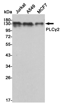 Western blot analysis of extracts from Jurkat,A549 and MCF7 cell lysates using PLCγ2 mouse mAb (1:1000 diluted).Predicted band size:148KDa.Observed band size:148KDa.