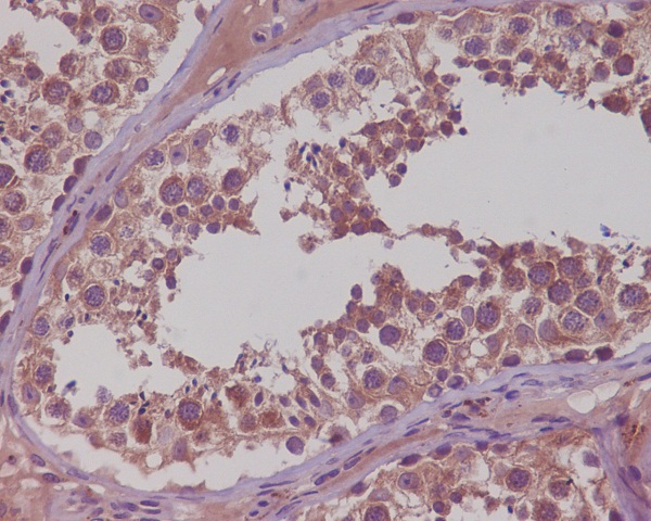 Immunohistochemical analysis of paraffin-embedded human testis, using NAK/TBK1 (N-term) Antibody.