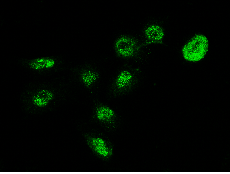 MECP2 Antibody, Rabbit PAb, Antigen Affinity Purified, Immunofluorescence