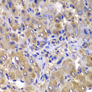Immunohistochemistry - CARD10 Polyclonal Antibody 