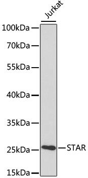 Western blot - STAR Polyclonal Antibody 