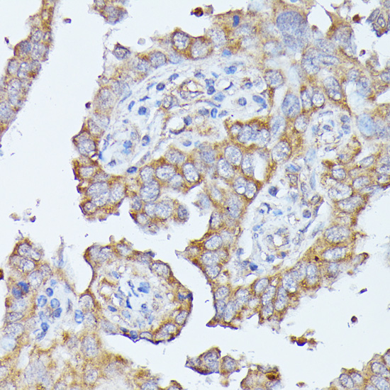 Immunohistochemistry - HAL Polyclonal Antibody 