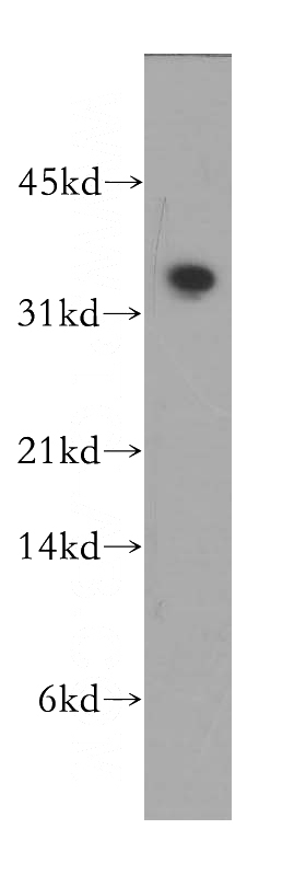 human heart tissue were subjected to SDS PAGE followed by western blot with Catalog No:114014(PLSCR4 antibody) at dilution of 1:400
