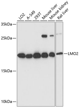Western blot - LMO2 Polyclonal Antibody 