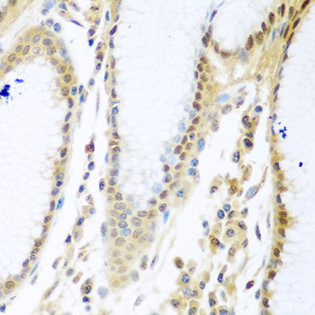 Immunohistochemistry - MYBBP1A Polyclonal Antibody 