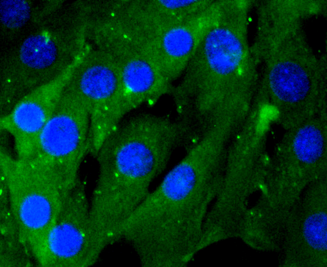 Immunofluorescence - RHOA/RHOB/RHOC Monoclonal Antibody 
