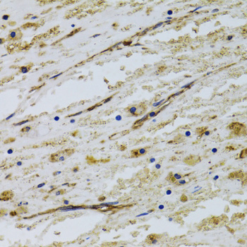 Immunohistochemistry - CD31 Polyclonal Antibody 