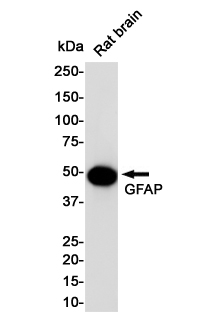 Western blot detection of GFAP in Rat Brain lysates using GFAP Rabbit pAb(1:1000 diluted).Predicted band size:50KDa.Observed band size:50KDa.