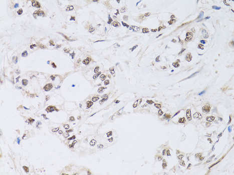Immunohistochemistry - PAX3 Polyclonal Antibody 