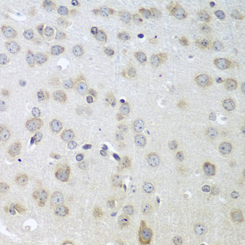 Immunohistochemistry - ACHE Polyclonal Antibody 