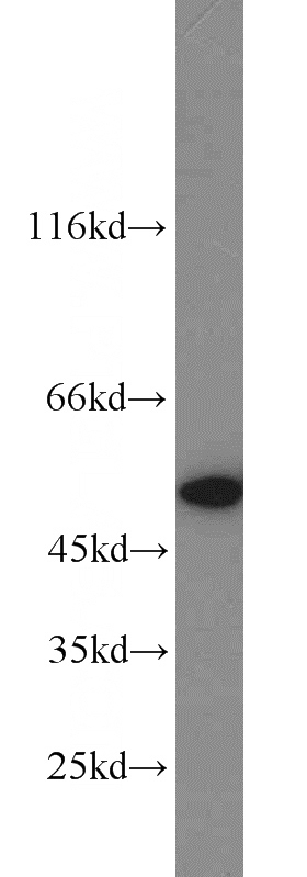 mouse heart tissue were subjected to SDS PAGE followed by western blot with Catalog No:116758(NAMPT antibody) at dilution of 1:1000