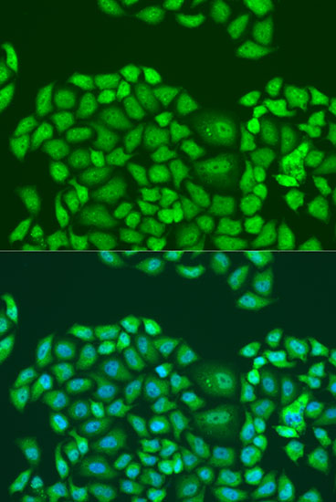 Immunofluorescence - SMN2 Polyclonal Antibody 