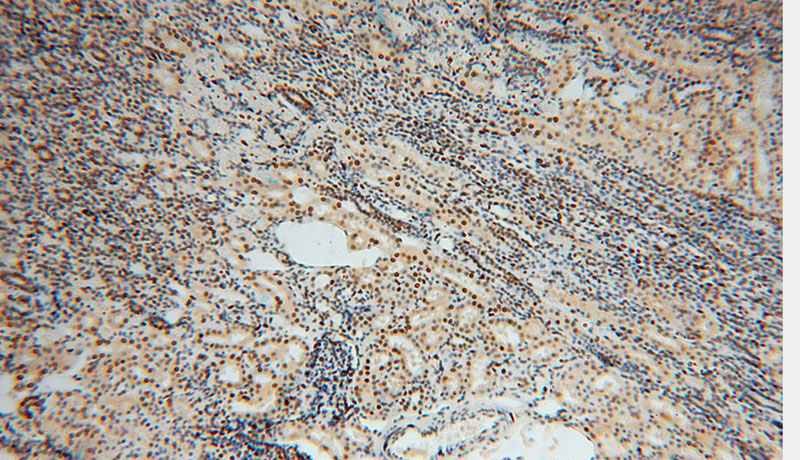 Immunohistochemical of paraffin-embedded human kidney using Catalog No:107258(HDGF antibody) at dilution of 1:50 (under 10x lens)