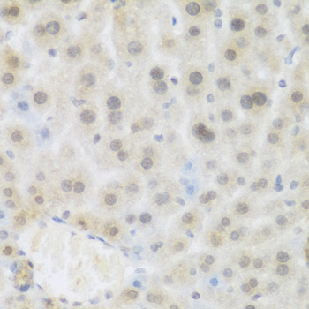 Immunohistochemistry - BRD9 Polyclonal Antibody 