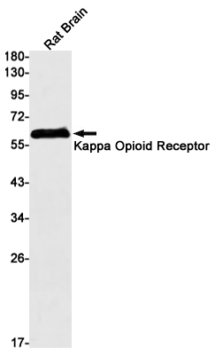 Western blot detection of Kappa Opioid Receptor in Rat Brain lysates using Kappa Opioid Receptor Rabbit mAb(1:1000 diluted).Predicted band size:43kDa.Observed band size:60kDa.