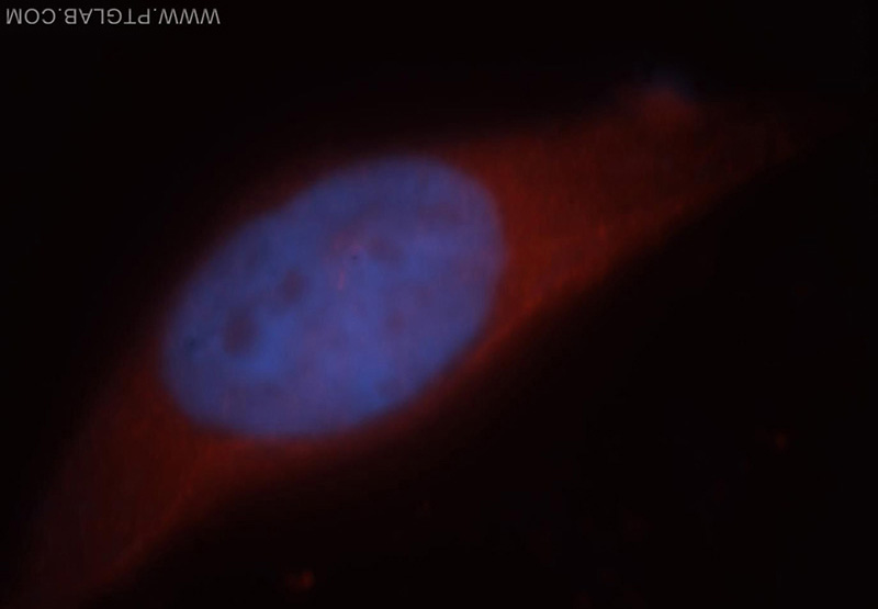 mmunofluorescent analysis of MCF-7 cells, using HEPACAM antibody Catalog No:111291 at 1:25 dilution and Rhodamine-labeled goat anti-rabbit IgG (red).Blue pseudocolor = DAPI (fluorescent DNA dye).