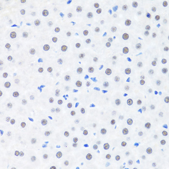Immunohistochemistry - BRMS1 Polyclonal Antibody 