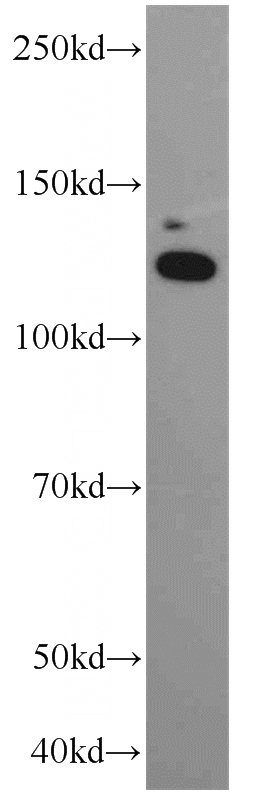 A431 cells were subjected to SDS PAGE followed by western blot with Catalog No:112888(CA15-3,MUC1 antibody) at dilution of 1:1500