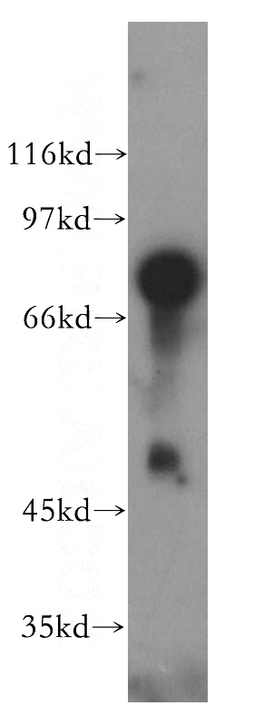 mouse brain tissue were subjected to SDS PAGE followed by western blot with Catalog No:117139(BHLHE41 antibody) at dilution of 1:500