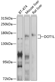 Western blot - DOT1L Polyclonal Antibody 