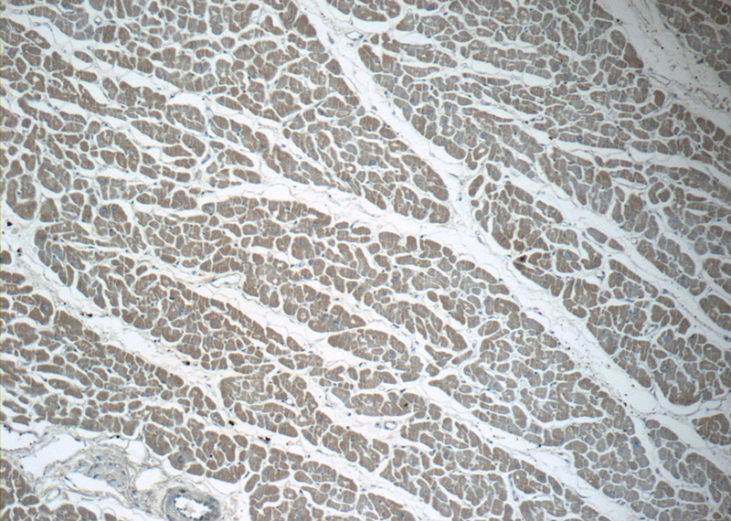 Immunohistochemistry of paraffin-embedded human heart tissue slide using Catalog No:115032(SDHB Antibody) at dilution of 1:50 (under 10x lens)